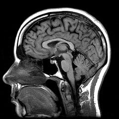 brain