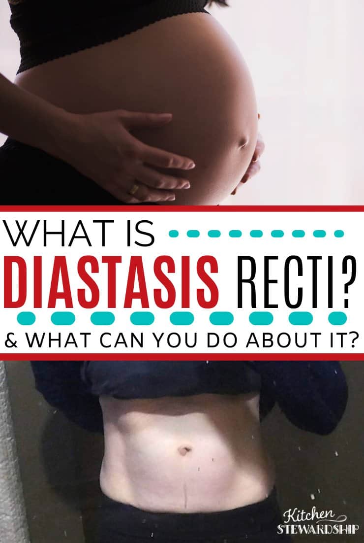 Diastasis recti is not just about looks. It can affect the daily functioning of your core for simple actions like lifting a toddler. what is diastasis recti?